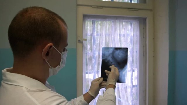 Doctor examining X-ray searching diagnosis. Doctor hand pointing on x-ray image.