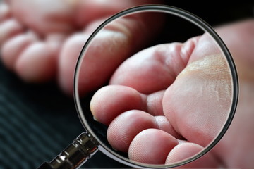 Checking finger 