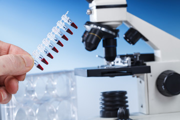 Microscope Subject Table and Biological Samples. Microscope is the main research tool in many scientific microbiology laboratories