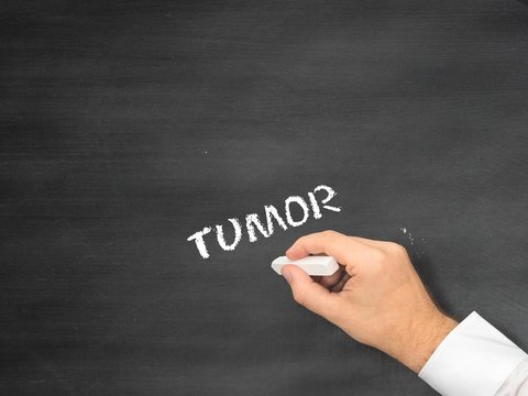 Tumor