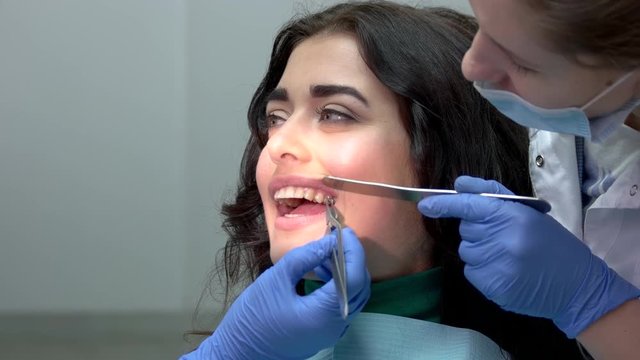 Dentist installing teeth braces. Hands of doctors in gloves. Dental brackets, pros and cons.
