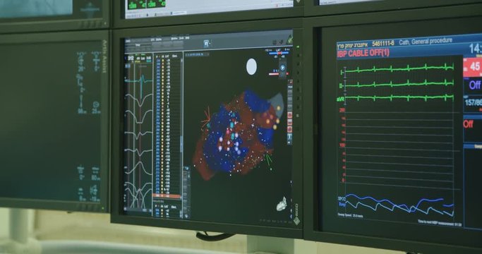 Surgeons watching monitors with x-ray images during a Cardiac catheterization procedure