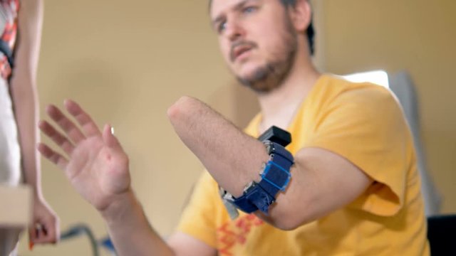 Disabled man with the amputated arm. Wireless sensor for bionic prosthesis control on his stump. 4K.