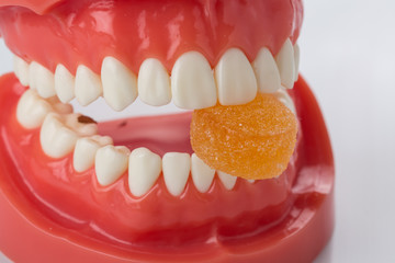 Dental model of the jaw