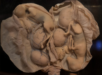Embryo of animals in uterus