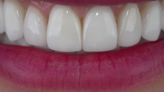 Slow motion close up: The young girl bites a kiwi. Minimally invasive porcelain veneers/ smile/ porcelain veneers color bleach