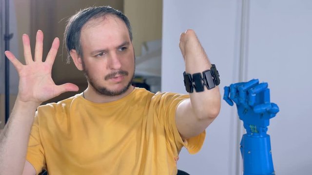 Man with the amputated hand controls robotic hand. 4K.