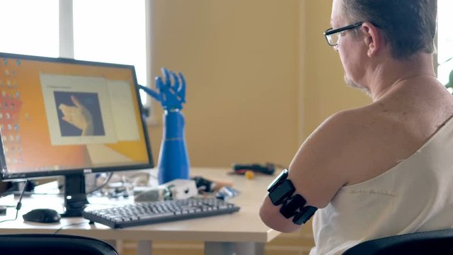 Man with the amputated arm using computer with wireless bionic sensors. 4K.