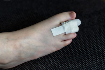 Broken toe and bandage on the dark background
