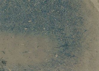 human body cells under a microscope