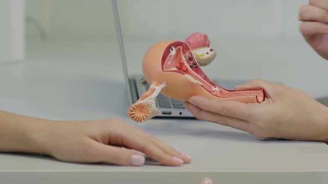Gynecologist doctor consulting patient using uterus anatomy model
