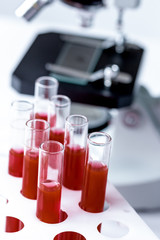 blood in glass tubes on background of microscope