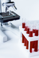 blood in glass tubes on background of microscope