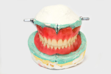 Dentures and Crowns