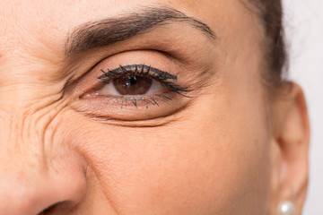 Fototapeta premium Visible wrinkles during a facial grimace of anger