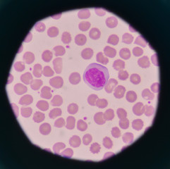 White blood cells on red blood cells background.