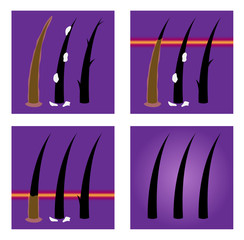 oily , dandruff and damaged hair vector icon