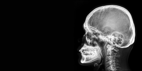 x ray of human head