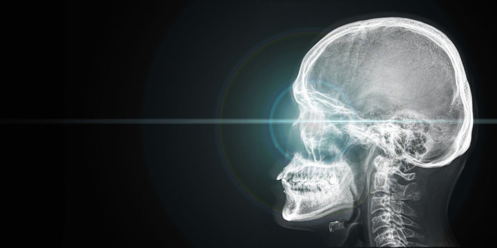 x ray of human head with light from eye