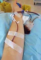 Arm of a man while donating blood