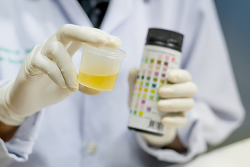 Doctor holding a container in hand, isolated on white background, Urine sample test.