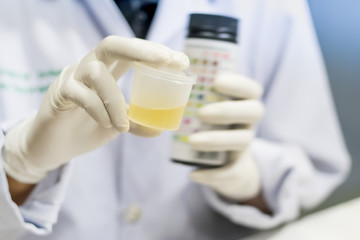 Doctor holding a container in hand, isolated on white background, Urine sample test.