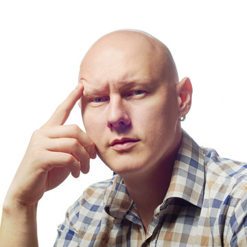 Autoimmune Total Alopecia Men Portrait. Absolute Bald Head Without Eyebrows