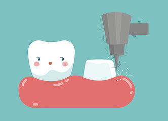 Dental crown installation process , tooth and teeth of dental concept