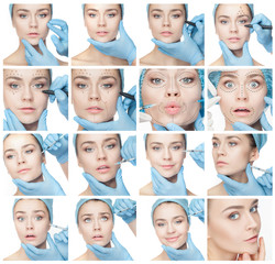 Fototapeta na wymiar Attractive woman at plastic surgery with syringe in her face