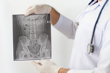 X-ray image of LS spine, AP view, show ankylosing spondylitis lumbar ,Doctor examining a lung radiography, Doctor looking chest x-ray film,Anatomy.
