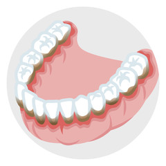 Dentition of the lower jaw - Periodontal disease