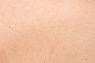 Fototapeta premium Details of young girl skin