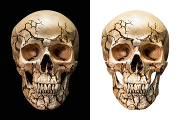 Cracked human skull