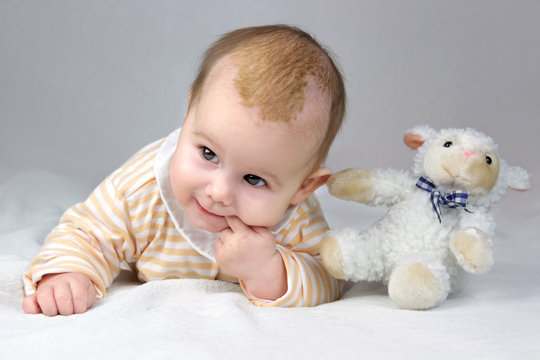 Drei Monate altes Baby mit Milchschorf liegt mit Plüschtier auf der Decke