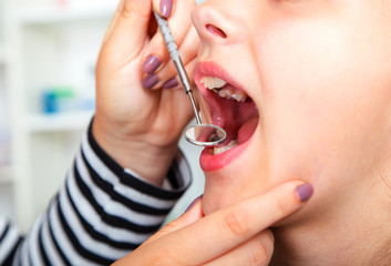 Close-up of little girl opening his mouth wide during treating h