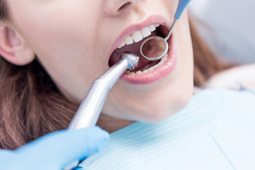 cropped shot of dentist curing teeth of woman in dental clinic