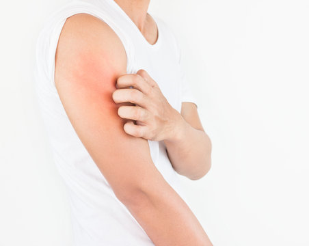 Young man scratch the itch on arm surface, Healthcare concept.