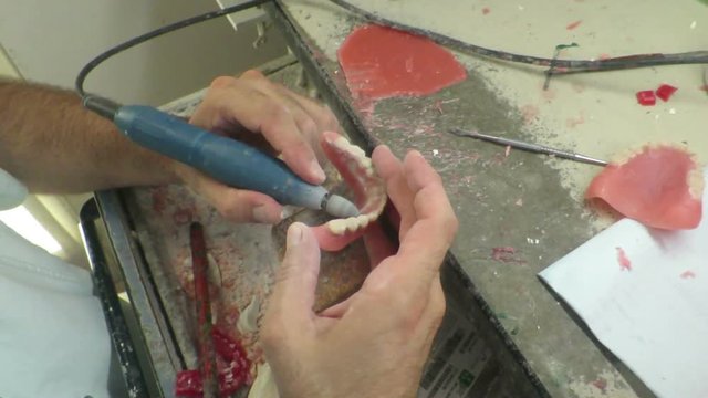 In un laboratorio dentale costruzione impianto dentale