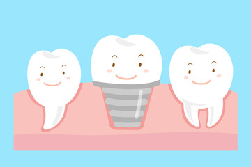 tooth with implant concept