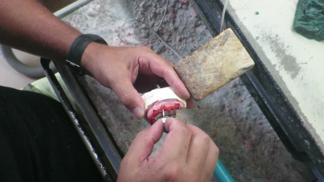 In un laboratorio dentale costruzione impianto dentale