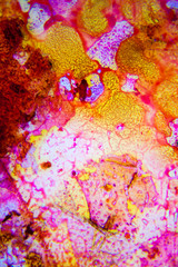 Images of biological tissues in a microscope. Real photo, blur zones possible