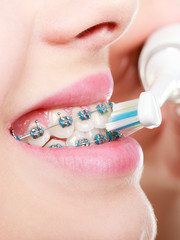 Woman brushing teeth with braces using brush
