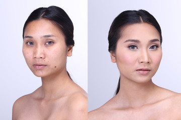 Asian Woman before and after make up. no retouch, fresh face with acne, skin moles, wart then good base and foundation cosmetic
