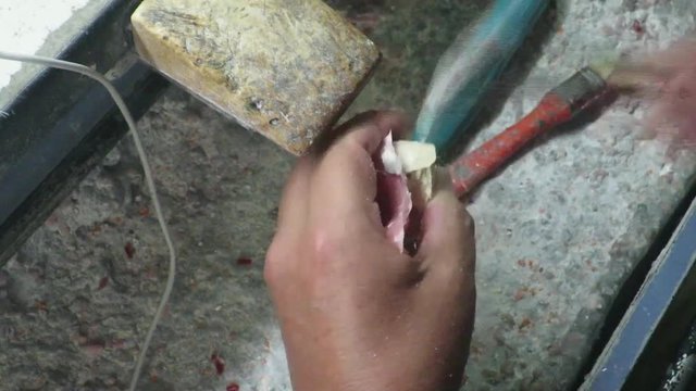 In un laboratorio dentale costruzione impianto dentale