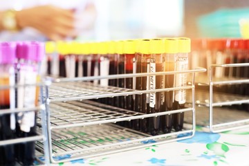 Blood sample tubes from blood donation for analysis.