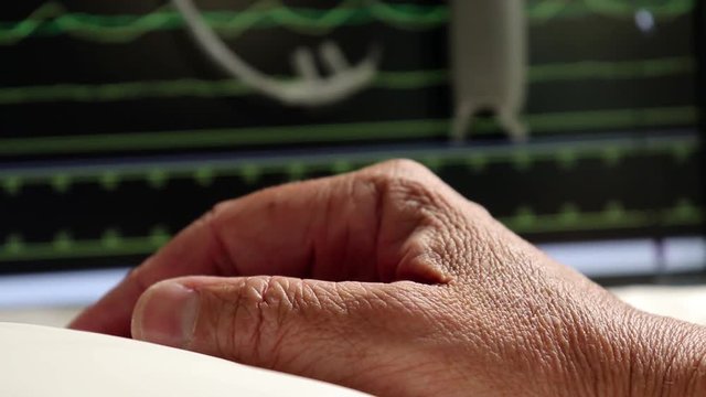 Main d'une personne ag&eacute;es hospitalis&eacute;es.