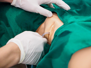 Close-up detail of a physician inserting a foley catheter into the vagina of a plastic training model. Healthcare and education concept.