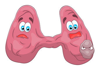 Cartoon thyroid with cancer