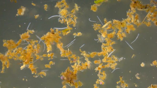 Tiny white worms from a pond, under stereo microscope
