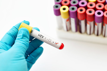 Obraz premium HIV positive